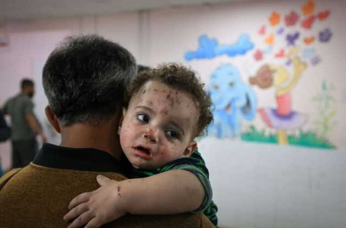 آنروا: جان ۲۰۰ هزار کودک در غزه به دلیل سوءتغذیه در معرض خطر است