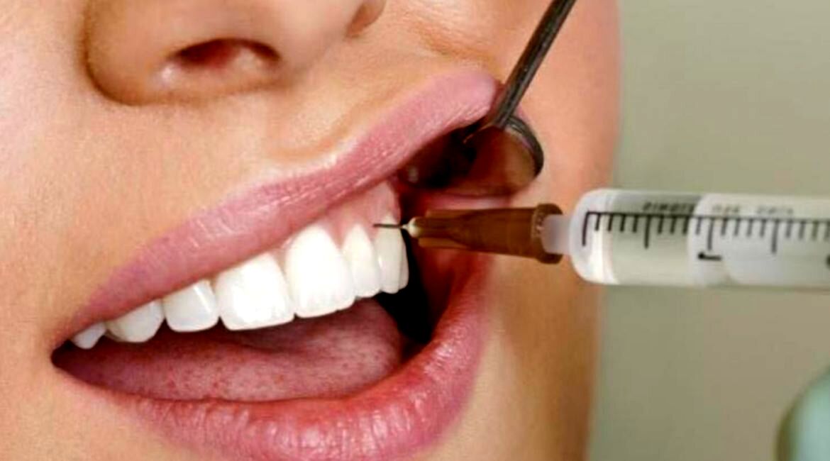 «پویش سلامت دهان و دندان» ۱۷ تا ۱۹ اردیبهشت برگزار می‌شود