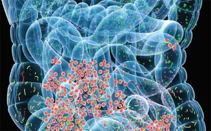 شایع‌ترین بیماری‌های گوارشی در ایرانیان