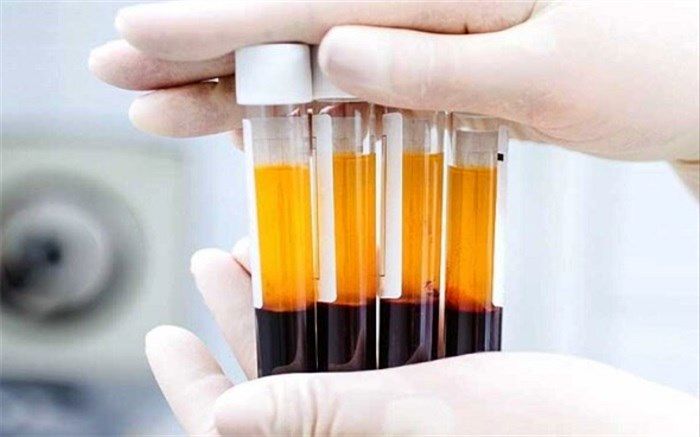 بهبودیافتگان کرونا با اهدای پلاسما به یاری دیگر بیماران بشتابند