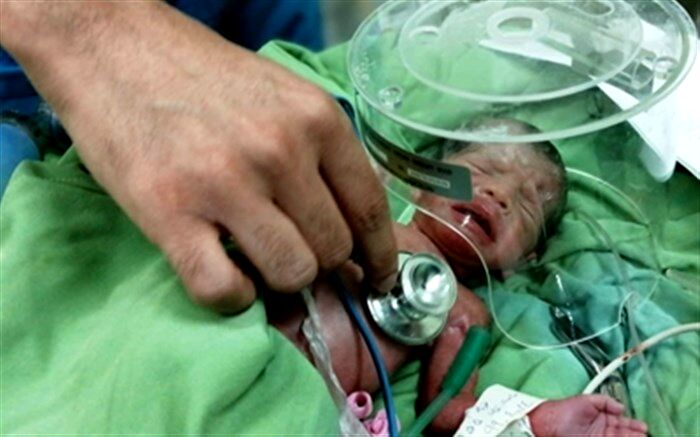 جراحان ماهر دانشگاه علوم پزشکی گیلان،  مادر باردار و نوزادش را نجات دادند