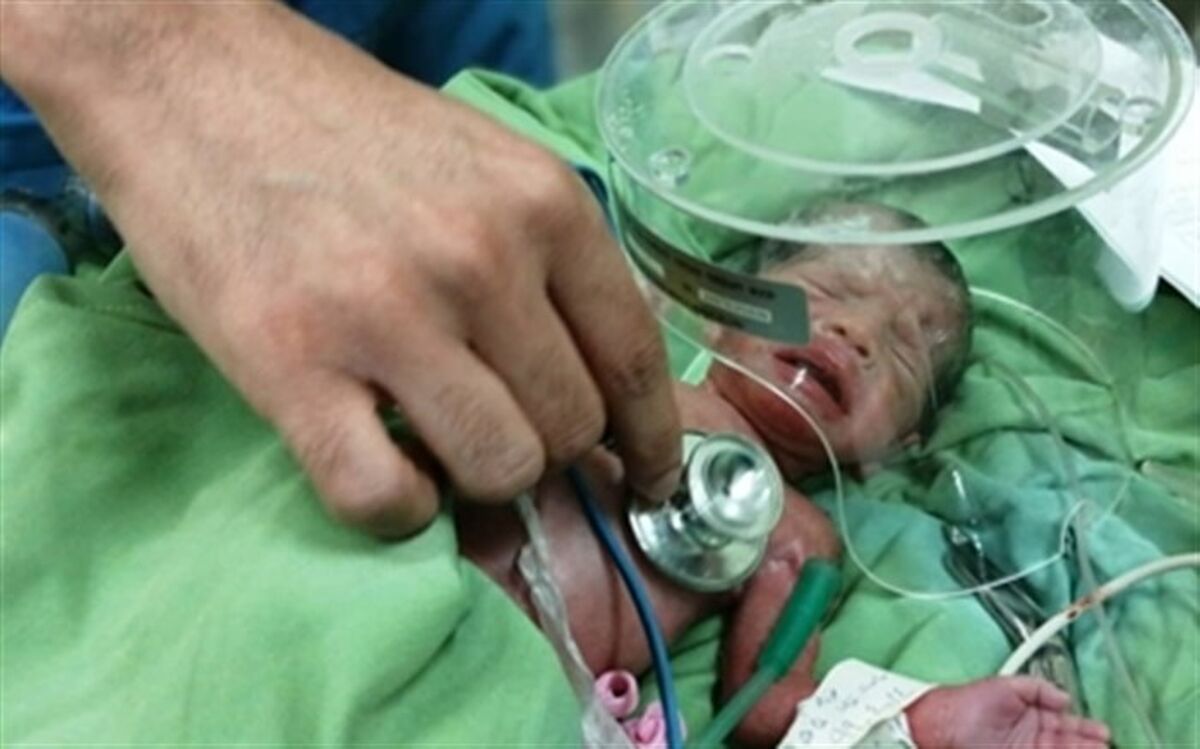 جراحان ماهر دانشگاه علوم پزشکی گیلان،  مادر باردار و نوزادش را نجات دادند