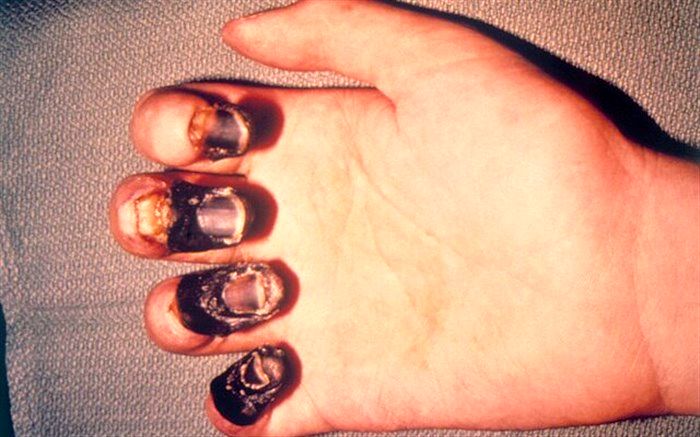 «طاعون خیارکی» اتفاق جدیدی نیست؛ شایعات را جدی نگیرید