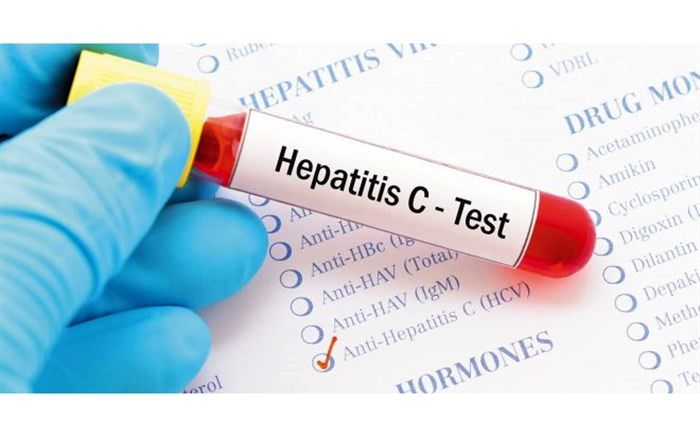 شیوع هپاتیت BوC در ایران پایین‌ترین نرخ در منطقه مدیترانه شرقی