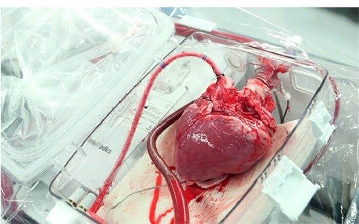 هفتمین  انتقال هوایی قلب پیوندی در سال جاری موفقیت‌آمیز بود