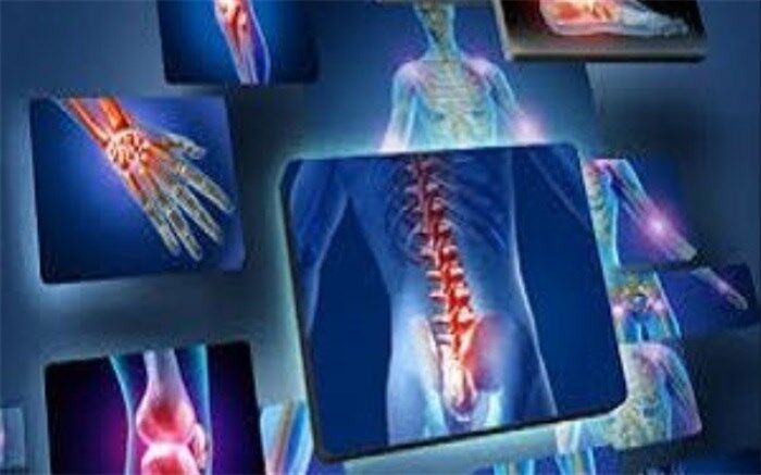 6  خوراکی مفید برای کاهش دردهای مفصلی+اینفوگرافیک
