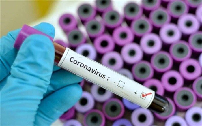 تست کرونا ستاره تراکتور تبریز مثبت شد