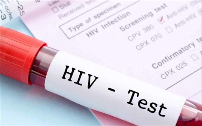 ویروس HIV از مادر به نوزاد منتقل می‌شود؟