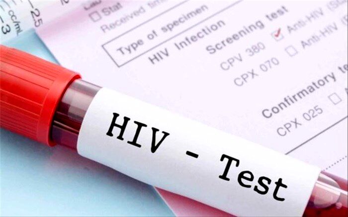 ویروس HIV از مادر به نوزاد منتقل می‌شود؟