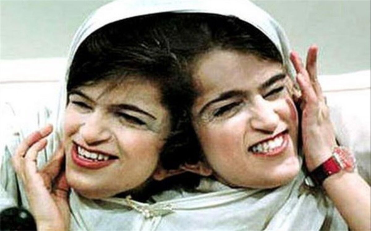 دوقلوهایی که باهم به استقبال مرگ رفتند