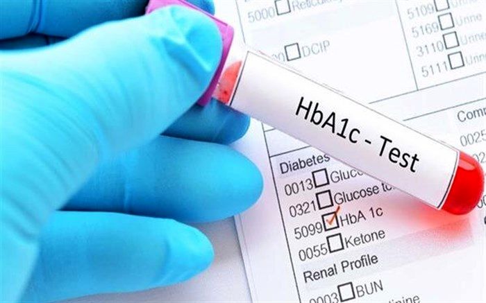 راه‌های پیشگیری و درمان دیابت نوع 2