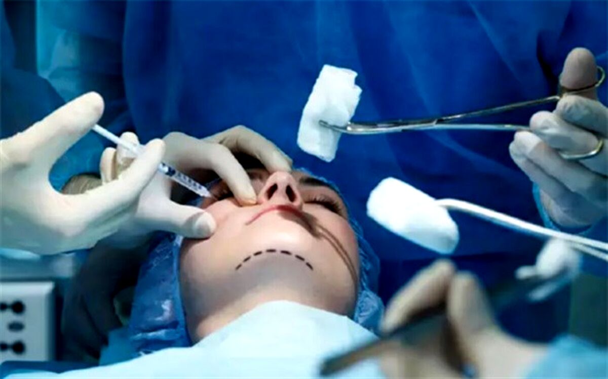 دختر چینی‌ای که رکورددار انجام عملی زیبایی است!