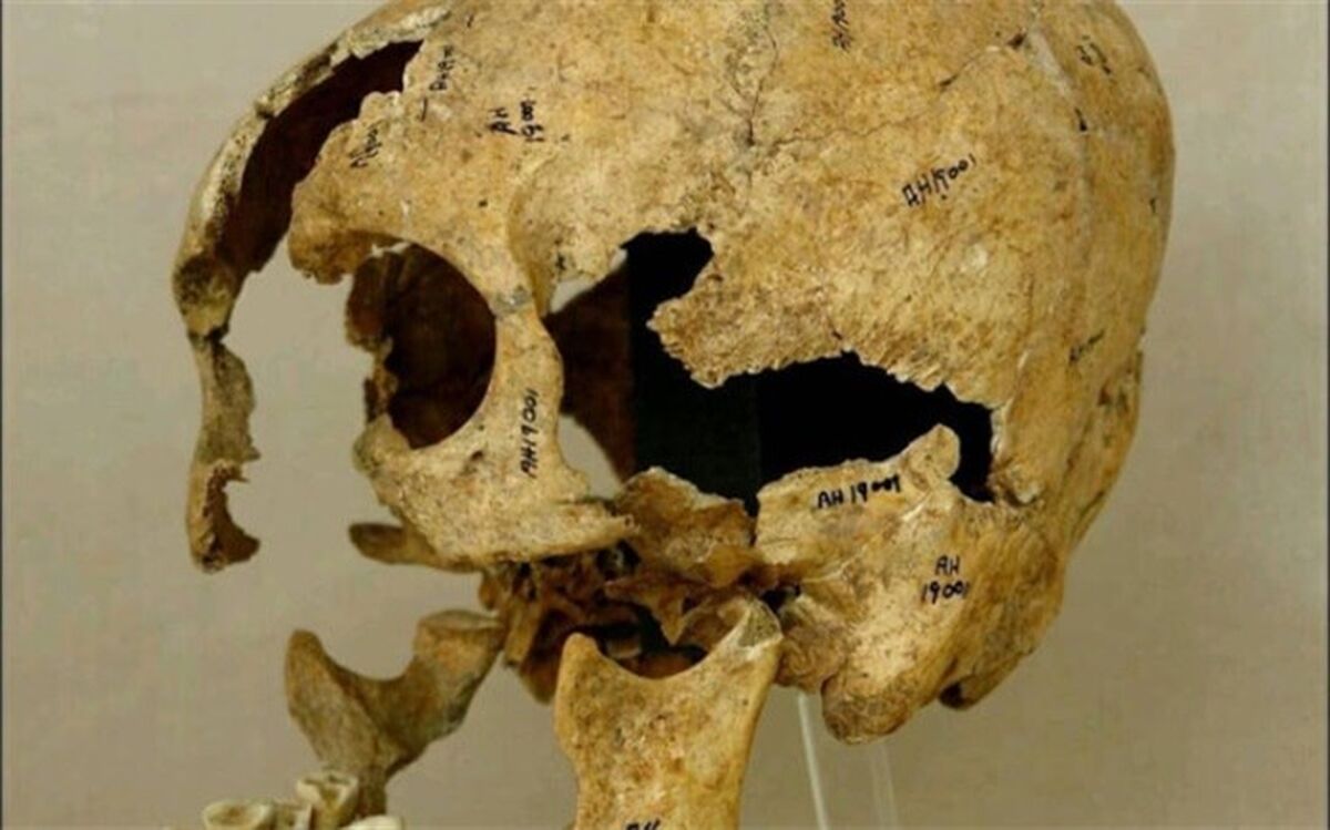 رازی که در جمجمه یک زن پنهان بود