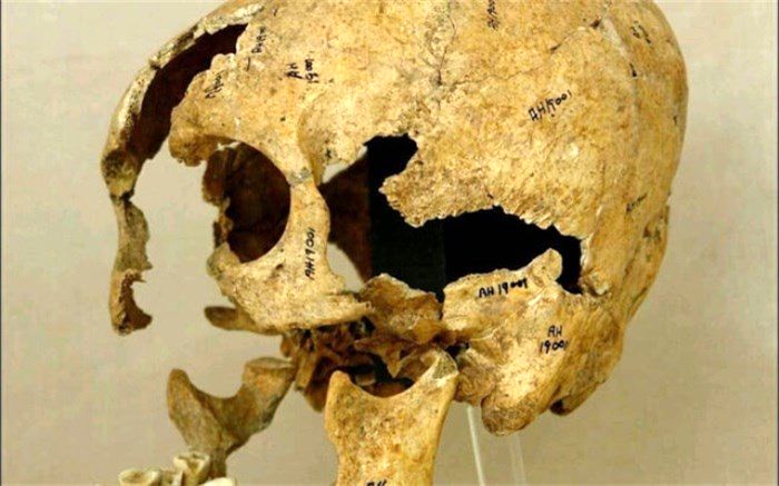 رازی که در جمجمه یک زن پنهان بود