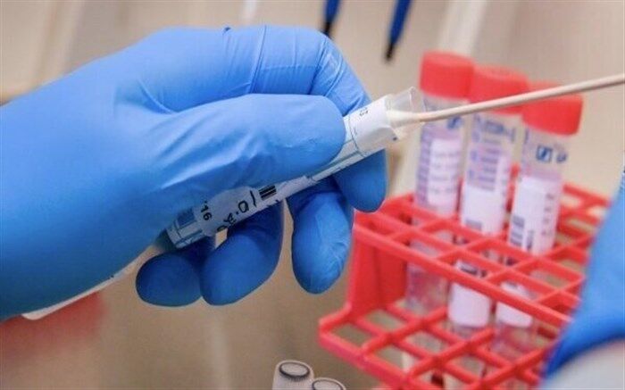 کرونایی‌های شناسایی شده در آذربایجان‌شرقی ۲۰ درصد افزایش یافت