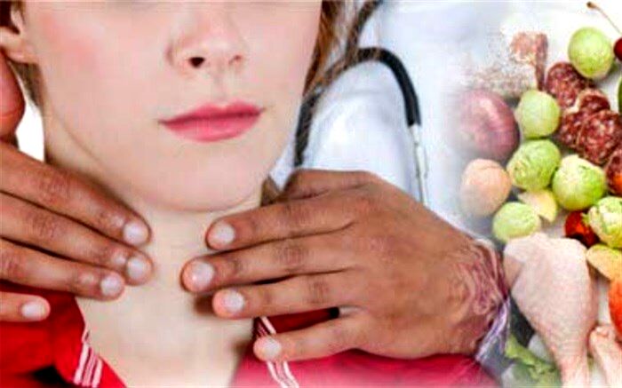 با نمک یددار و رژیم غذایی، تیروئید را درمان کنید