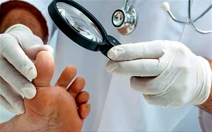 عفونت‌های پوستی شایع در فصل گرما