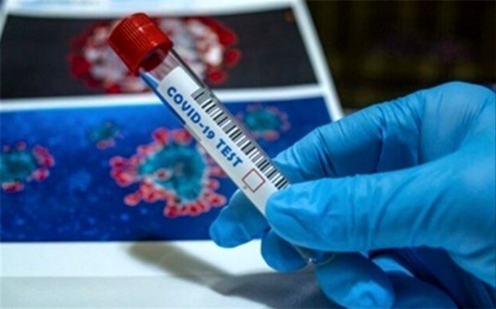 انجام ۵۸ هزار تست pcr در مرزهای کشور