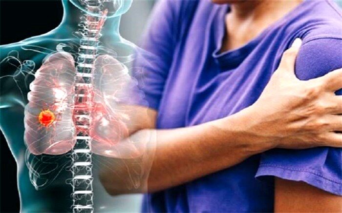 اگر متوجه این درد شدید، ریه‌­هایتان را چک کنید