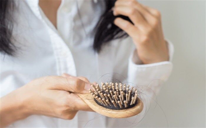 با حذف این غذا‌ها از ریزش مو جلوگیری کنید