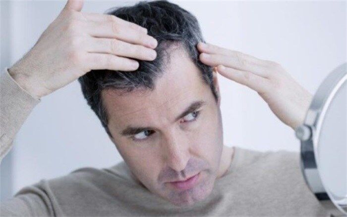 چه کنیم تا موهای مان سفید نشود