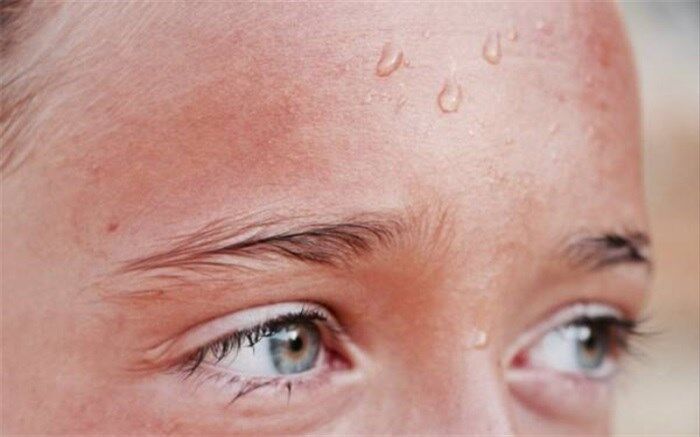 9 دلیل و علت اصلی عرق زیاد بدن