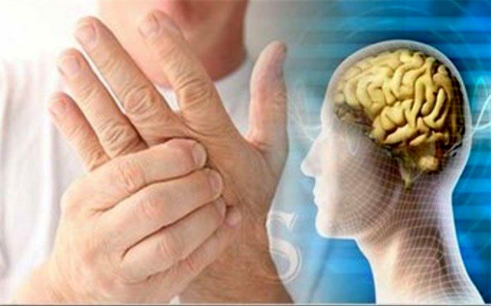 وجود ۷۰ هزار مبتلا به ام‌اس در ایران