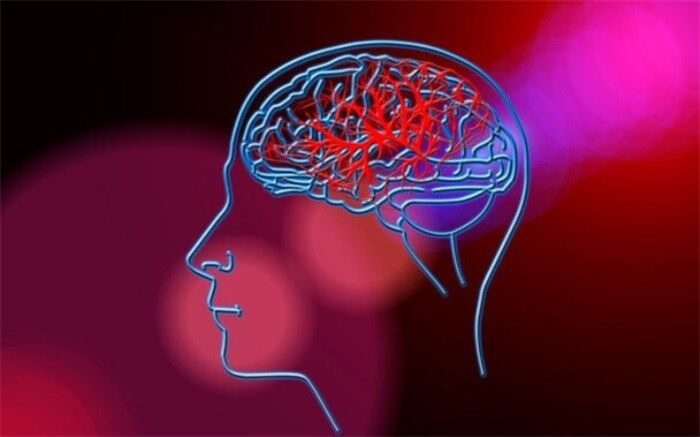 پیش‌بینی احتمال سکته مغزی با یک تراشه