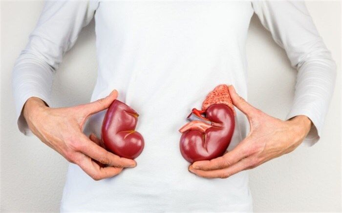 چگونه افزایش دما خطر ابتلا به بیماری کلیوی را افزایش می‌دهد؟