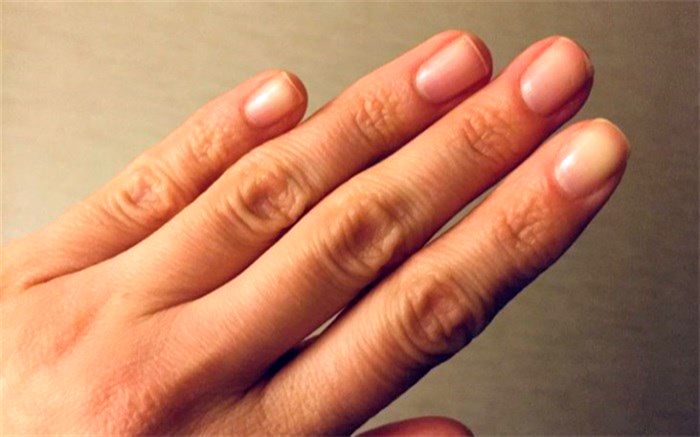 تاثیر استرس در رشد ناخن‌ها