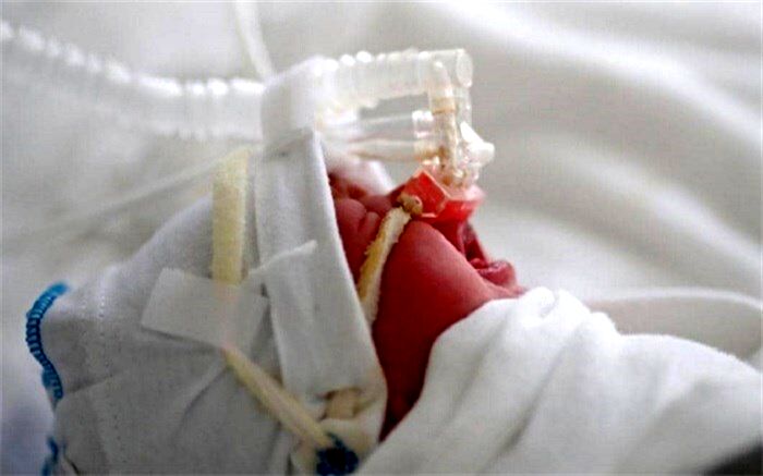 همه آنچه که باید درباره ویروس "RSV"بدانید