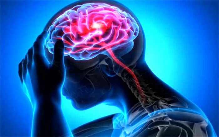 کمبود این ویتامین باعث سکته مغزی می‌شود