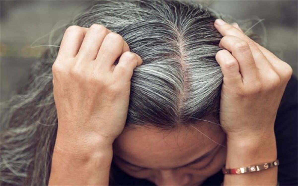 موهایتان به این دلیل سفید می‌شود