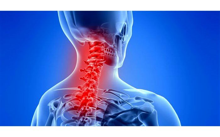 راه‌‌های درمان بدون جراحی  آرتروز گردن