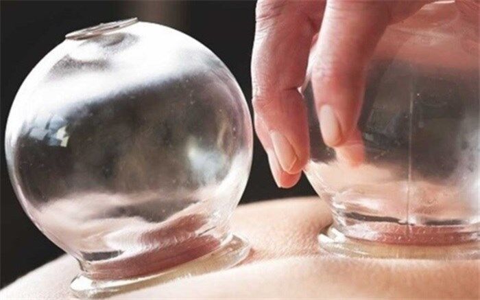 حجامت در چه سنینی و برای چه کسانی سم است