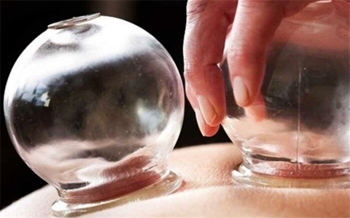 حجامت در چه سنینی و برای چه کسانی سم است