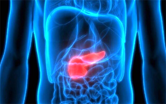 سرطان پانکراس در کمین کدام افراد است