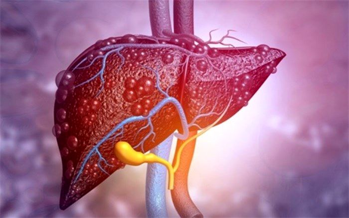 نشانه‌های ‌نارسایی کبد که باید جدی گرفته شوند
