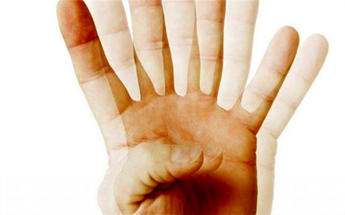 عارضه دوبینی را جدی بگیرید