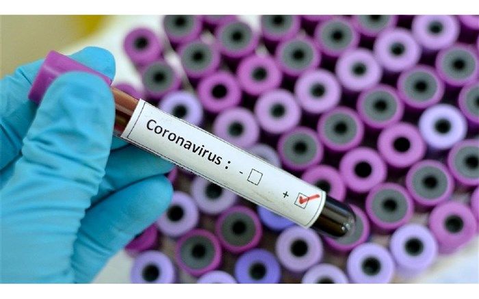 بستری ۲۳ بیمار جدید مبتلا به کرونا در استان اردبیل