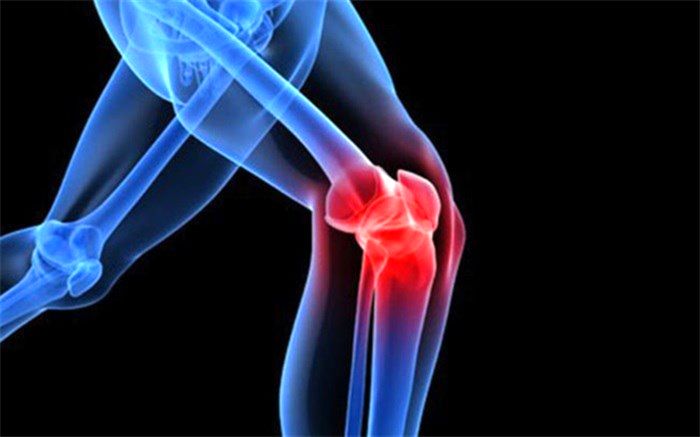 5 غذایی که درد زانو را کاهش می‌دهد