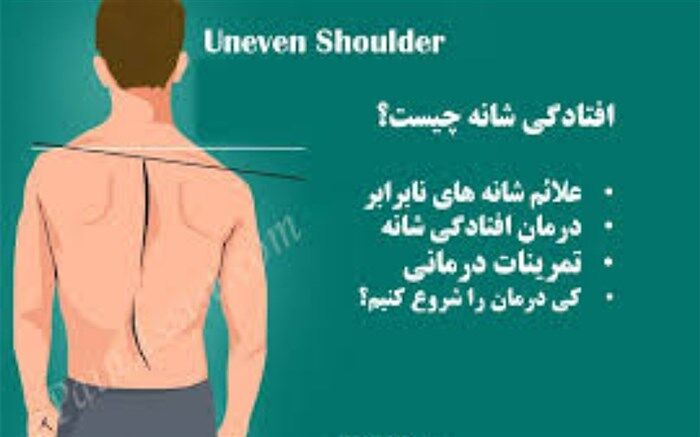 علت بدفرمی بدن  چیست