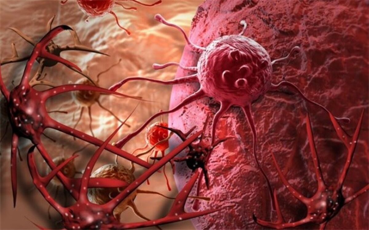 سالانه بیش از 6 هزار مبتلای جدید به سرطان سینه در ایران تشخیص داده می‌شود