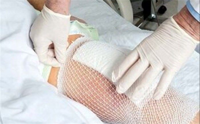 چطور بفهمیم زخم‌مان نگران‌کننده است یا خیر؟