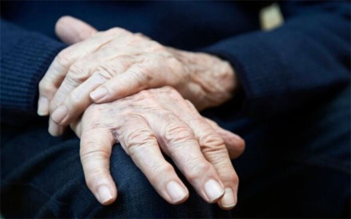 ۴۲۰۰ ایرانی هر سال به خاطر پوکی استخوان فوت می کنند