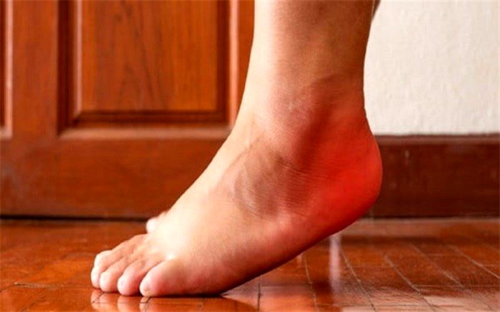 ورم پا به چه دلایلی ایجاد می‌شود؟