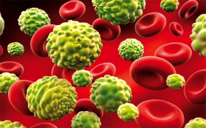 افزایش نگران‌کننده سرطان در شهرستان آذرشهر