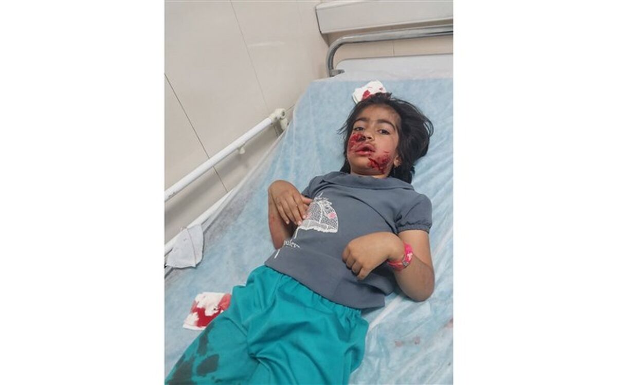 حمله دردناک یک سگ به 4 نفر در بیرجند