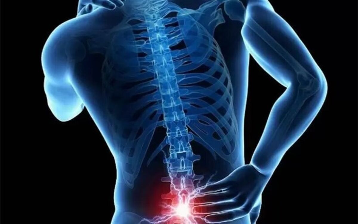 اختلالات اسکلتی در جوانان کشور چه میزان است؟