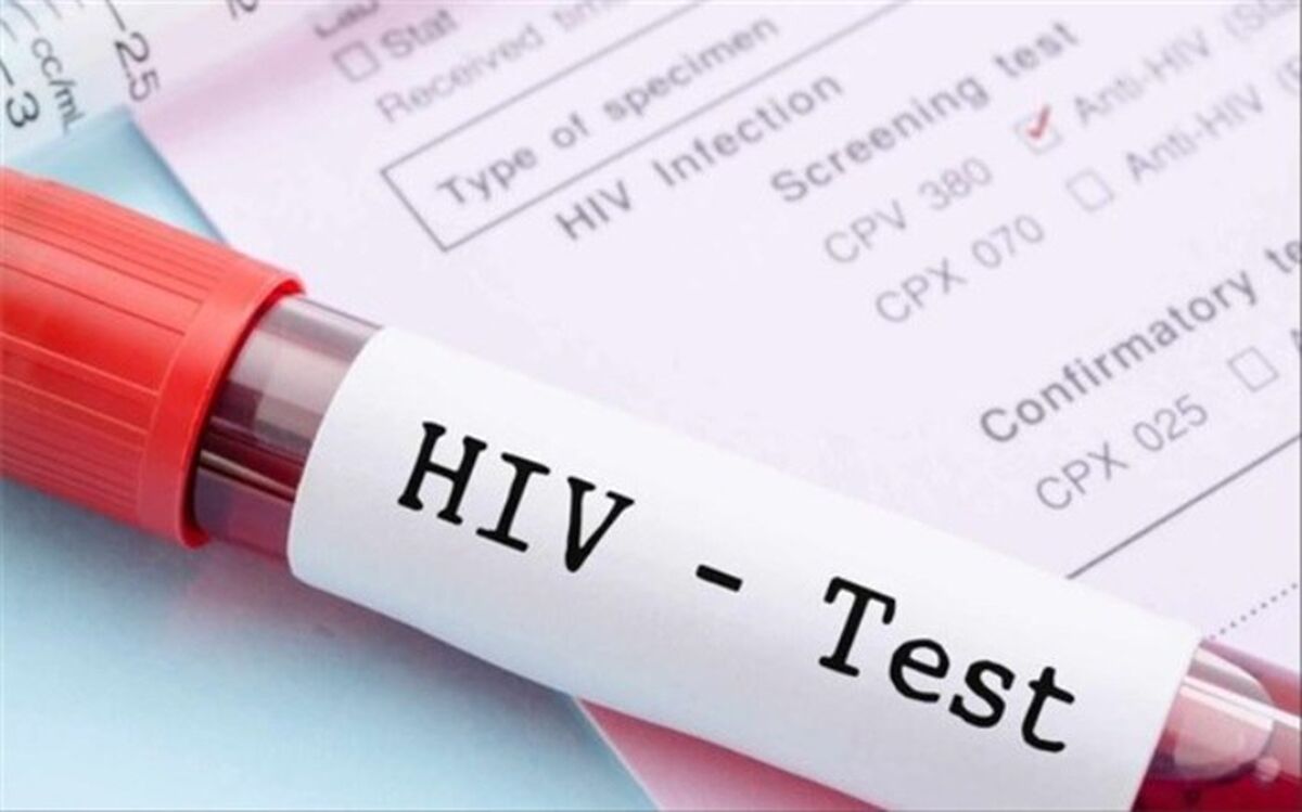 جدیدترین آمار بیماری HIV در کشور اعلام شد